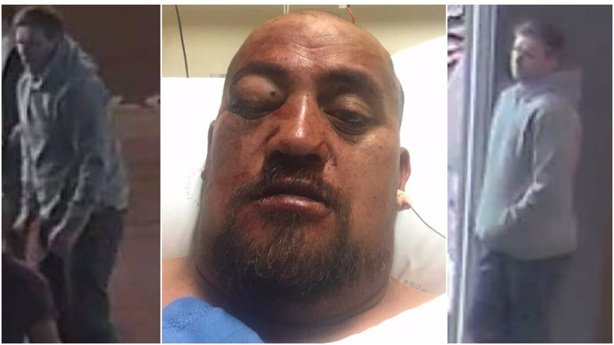 Police would like to speak to the man on the left and right of this image. Middle: victim Andrew Teao after the attack.