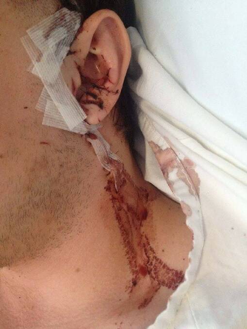 David Merxhushi's wound came within centimetre of carotid artery. Photo: supplied