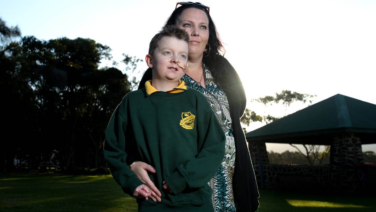 Fragile: Warilla mum Rebecca O'Brien with her son Billy, 12, who suffers from the rare genetic skin condition Epidermolysis Bullosa, or EB for short.