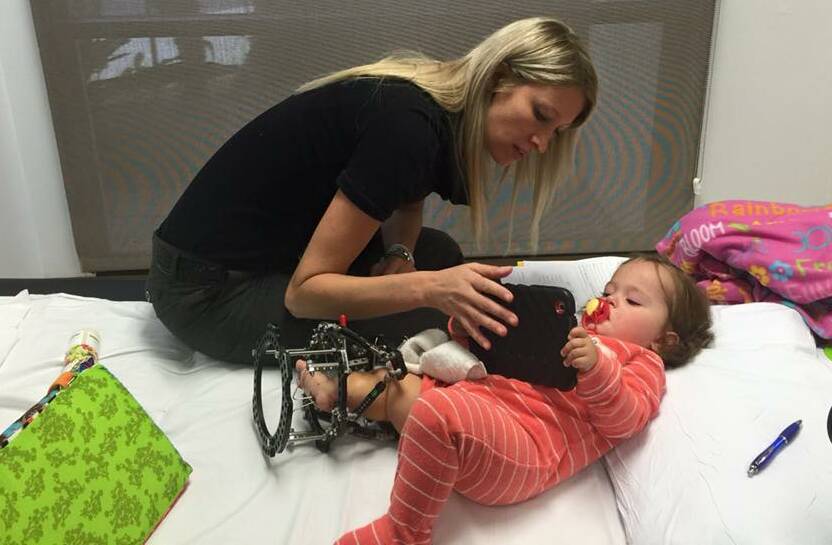 Steady progress: Little Sophia undergoing her first physiotherapy session after corrective surgery for a rare limb deficiency in the US last month.