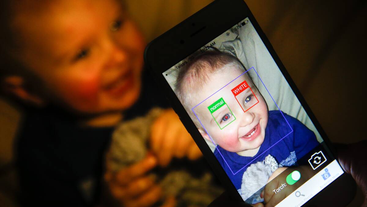 Know the glow: A new app to detect eye cancer indicates an area of concern in the left eye of Patrick Rowles, who has been treated for retinoblastoma. Picture: Adam McLean