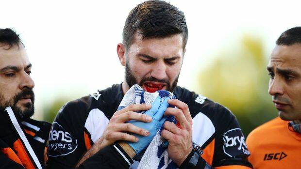 James Tedesco leaves the field with a suspected broken jaw. Photo: Getty Images
