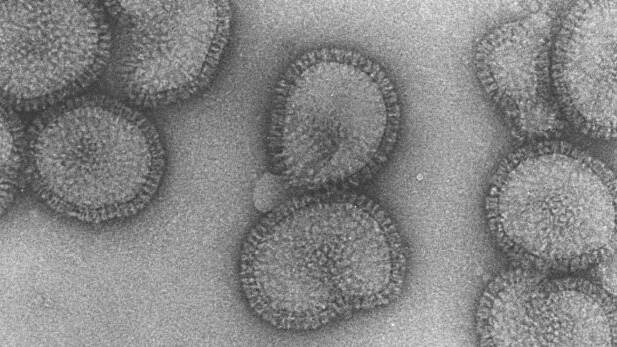 An electron microscopy image of the flu virus. Photo: Rob Ruigrok/ UVHCI
