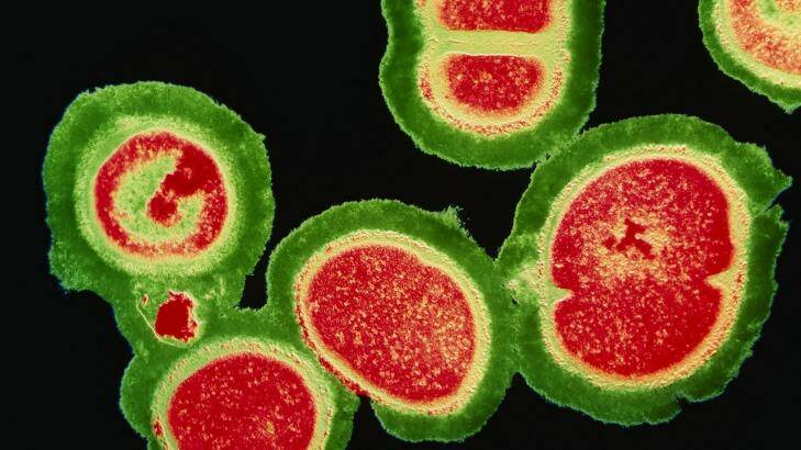 A deadly cluster of resistant staphylococcus bacteria. Photo: Science Photo Library