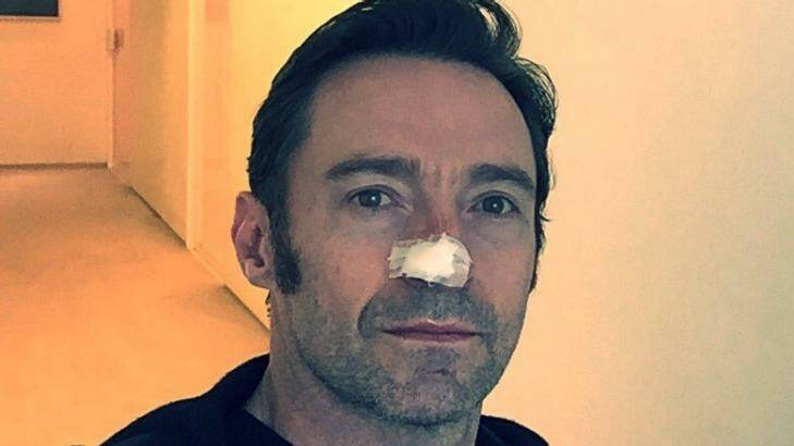 Hugh Jackman had his sixth skin cancer removed from his face. Photo: Hugh Jackman/Twitter