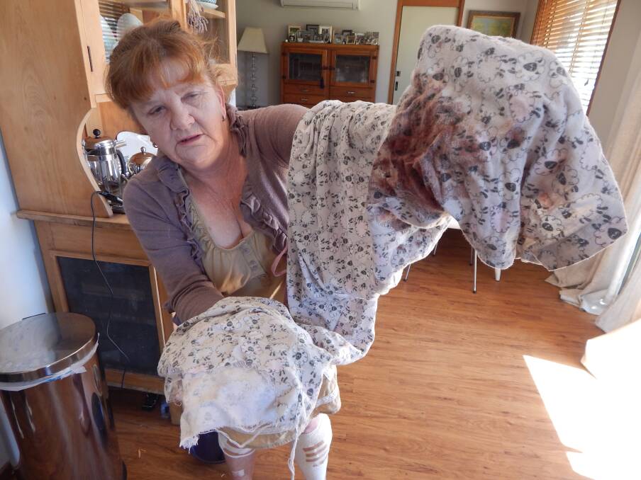 Bronwyn O'Brien with her pyjama pants that were torn and bloodied when she was attacked by a dog at the weekend. Photo: ANGELA CLUTTERBUCK.