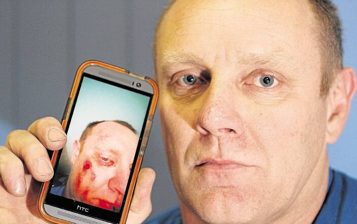 NOT SATISFIED: Burnie man Frank Aldridge with a picture of some of his injuries sustained in the attack.
Picture: Stuart Wilson.