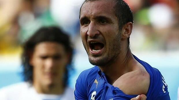 Bite marks: Italy's Giorgio Chiellini shows where he was bitten by Uruguay's Luis Suarez. Photo: Reuters