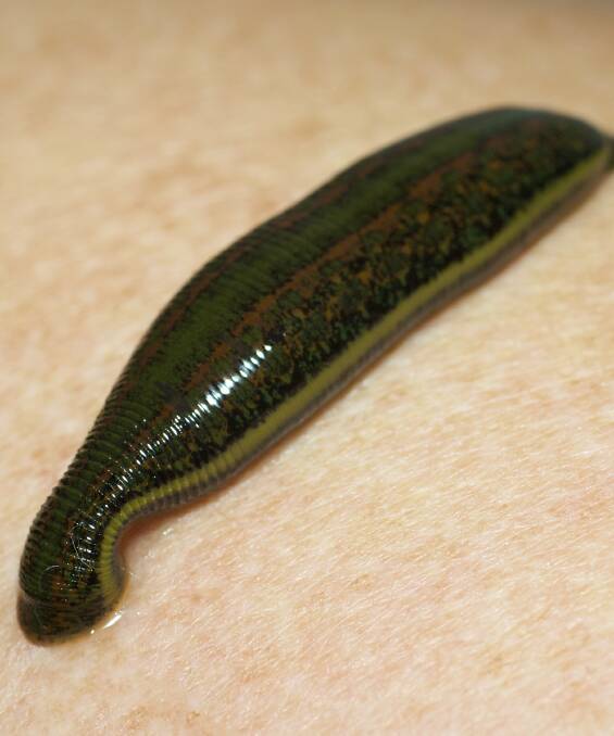 British backpacker relieved to lose leech