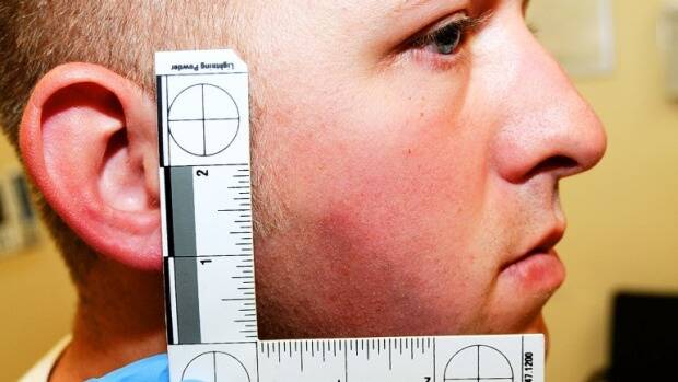 A photo of police officer Darren Wilson with a bruise on his face shortly after he fatally shot black teenager Michael Brown. The image was used as evidence by the grand jury. Photo: AFP