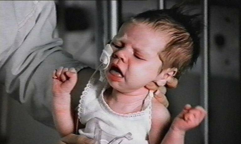 Whooping cough outbreak hits northern Illawarra