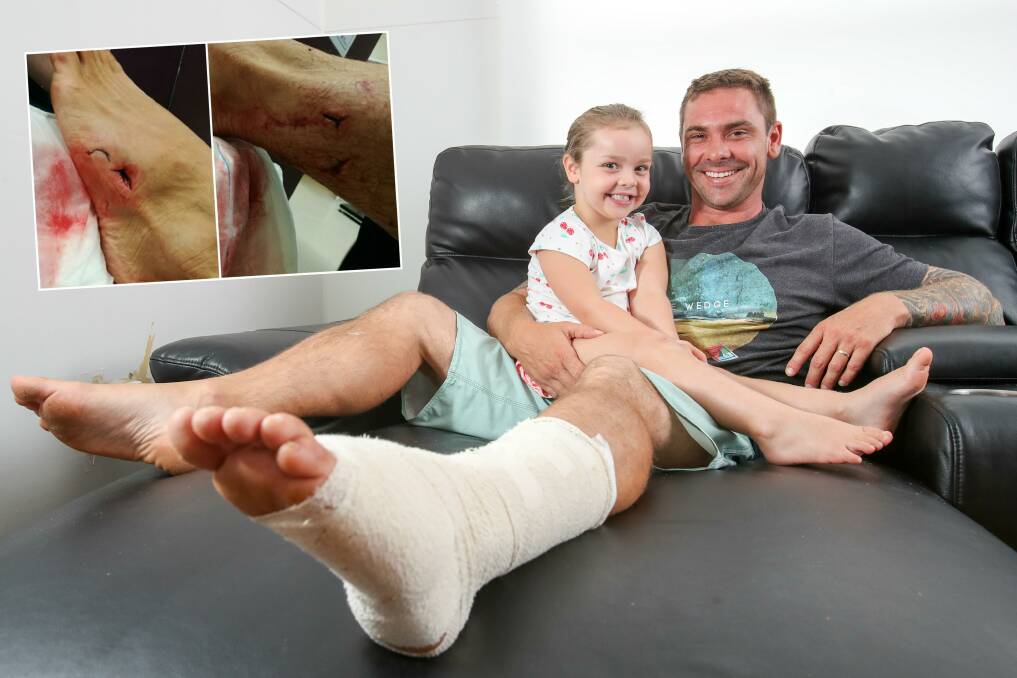 Adam Hoare at home with his daughter April, 3, on Friday morning. The 35-year-old was injured (inset) during a shark incident at Kiama on Thursday. Main picture: Adam McLean