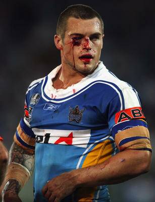 Daniel Conn, then of the Titans, bleeds after a dust-up with Michael Weyman in 2008.