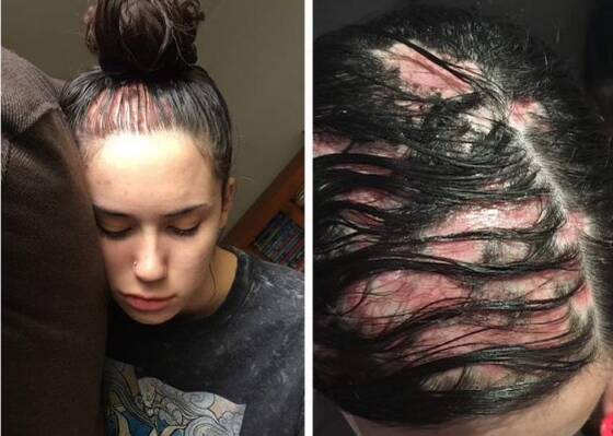 Eve's mother, Casey Walker, watched how her daughter transformed into "a shell of her usual self" due to the hair loss. Pictures: supplied. 