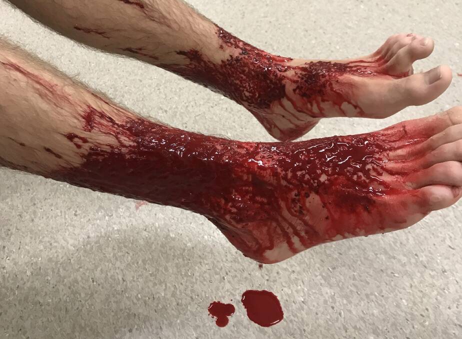 Sam Kanizay's feet after he emerged from the water at Brighton Beach. Photo: supplied
