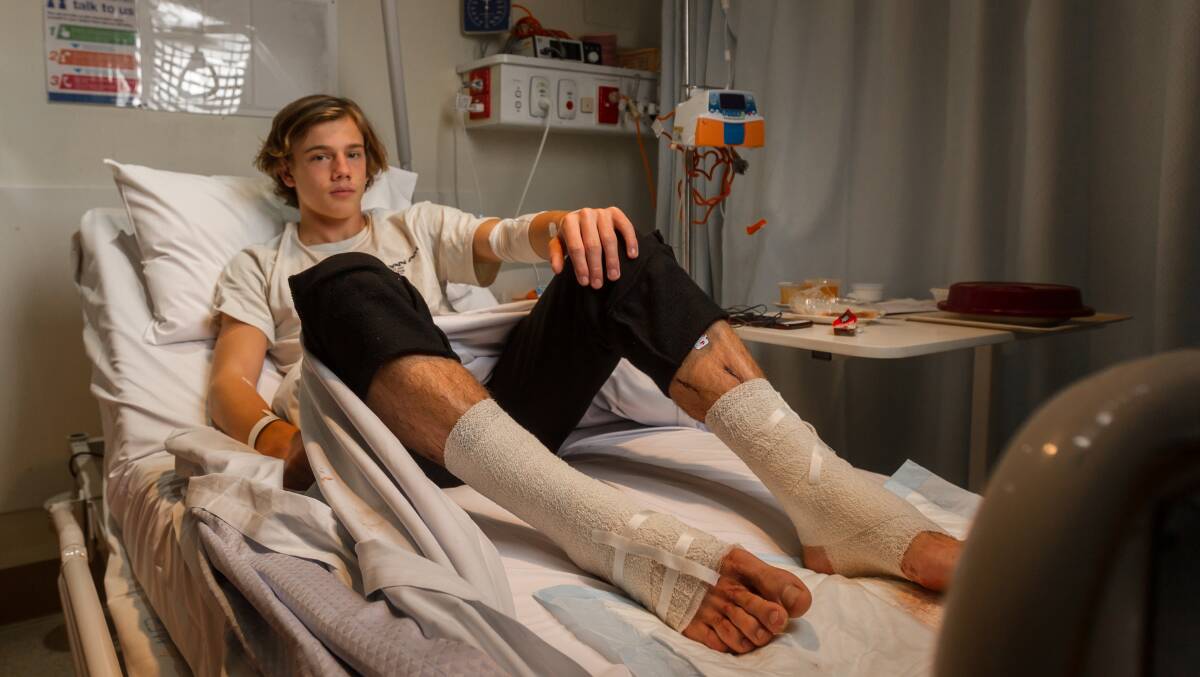 Still in shock: Sam Kanizay's wounds were seeping blood at Dandenong Hospital on Sunday, 18 hours after he emerged from the bay at Brighton with bloody legs, possibly by tiny bay creatures. Photo: Scott McNaughton