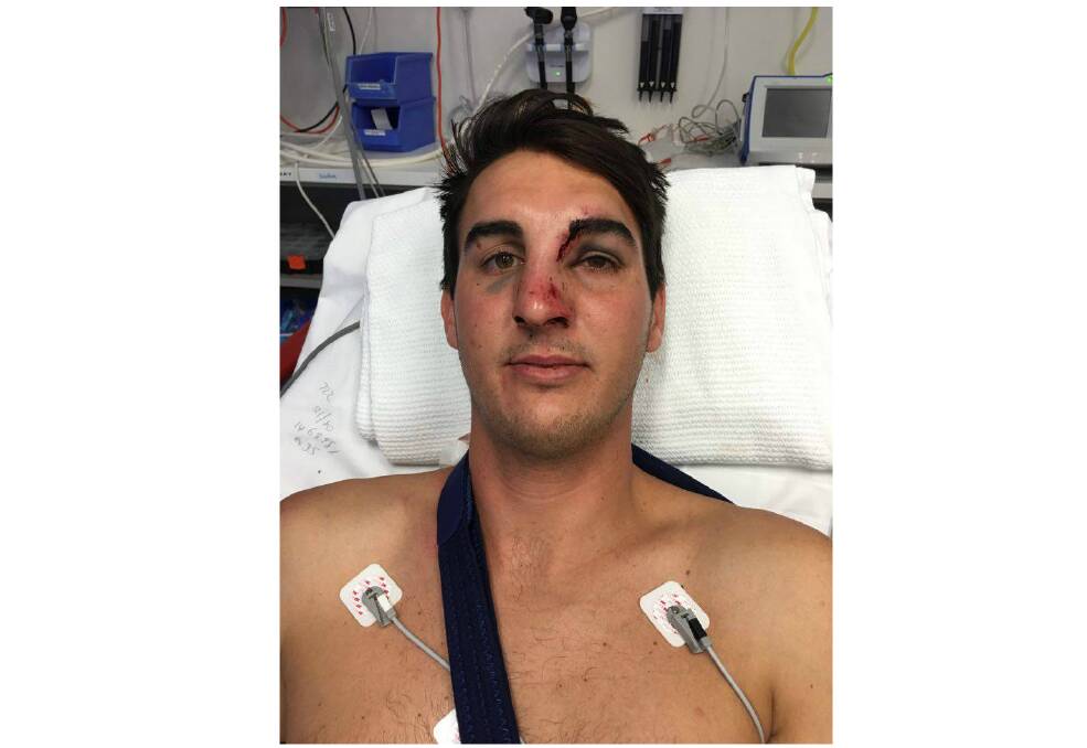 Jackson Crinis is receiving treatment at Wollongong Hospital in the aftermath of the attack. Crime Stoppers:1800 333 000. Picture: supplied