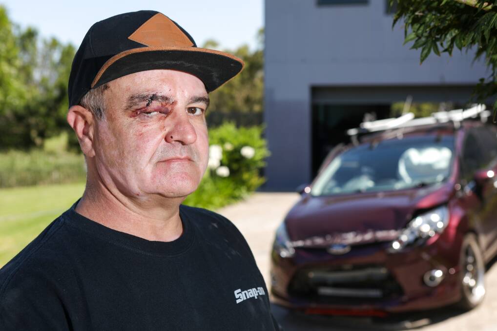 Hero: Mr Robinson ended up with stitches in a wound after trying to stop a man from stealing his neighbour's car. 