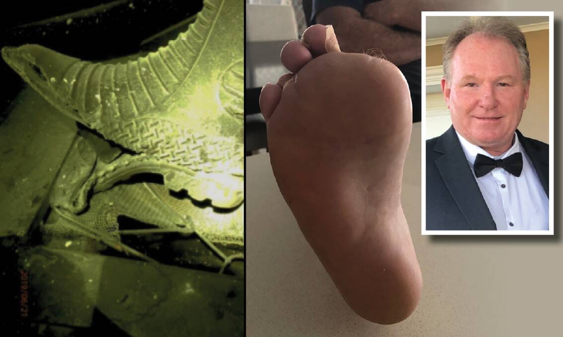 Accident: Miner Jeff Rapley (right) had two toes amputated after an accident at South32's Appin mine when his gumboot-clad foot (left) was caught in a scraper conveyor.