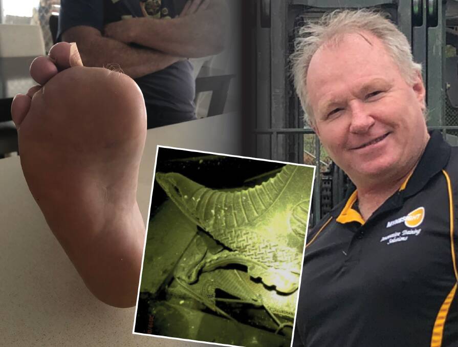 Injury: Jeff Rapley has not been able to work since he lost several toes after an accident at Appin mine several years ago. Pictures: supplied