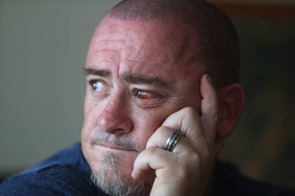 Pain: Marc Dudley was attacked by another patient while in Shellharbour Hospital. If his story triggers you call Lifeline on 131114. Picture: ROBERT PEET