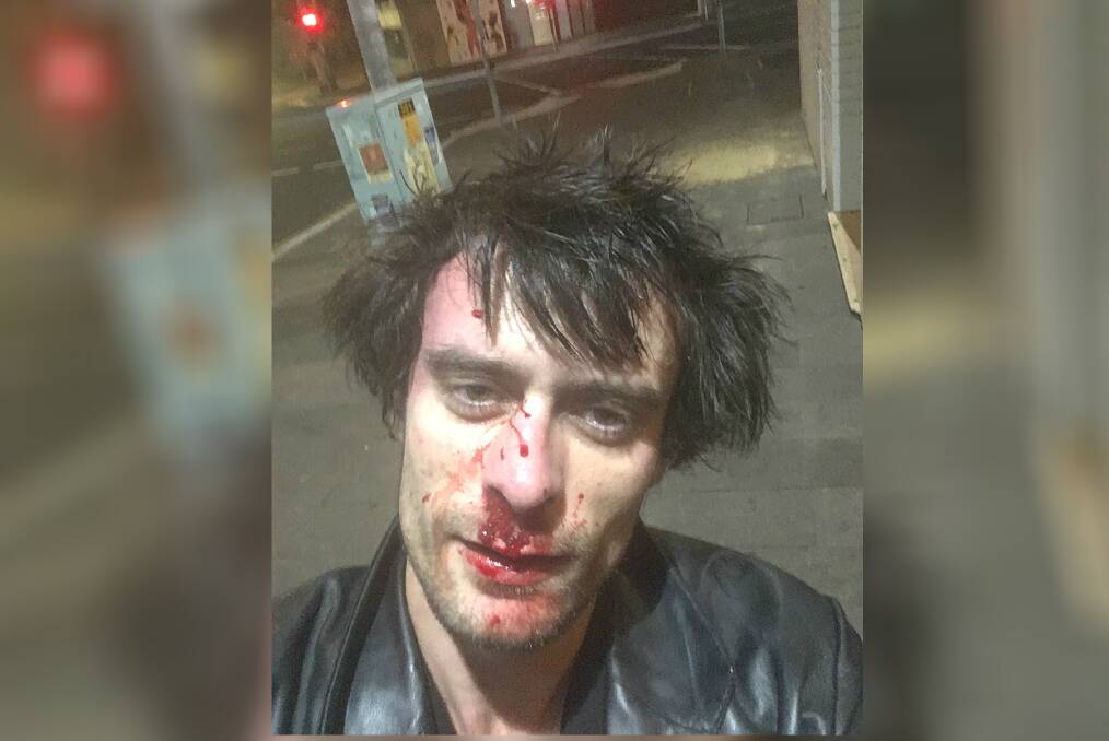 Wollongong's Michael Ralph was assaulted by a group of men on Wednesday night in Crown Street Mall after he went to the aid of another man. Picture: Michael Ralph