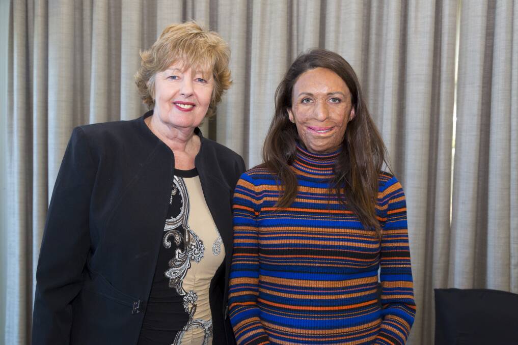 Dynamic business networking: The IWIB attracts top speakers at their networking lunch events. On the right is Turia Pitt, flanked by director of IWIB Glenda Papac. Photo: NEG Photography.
