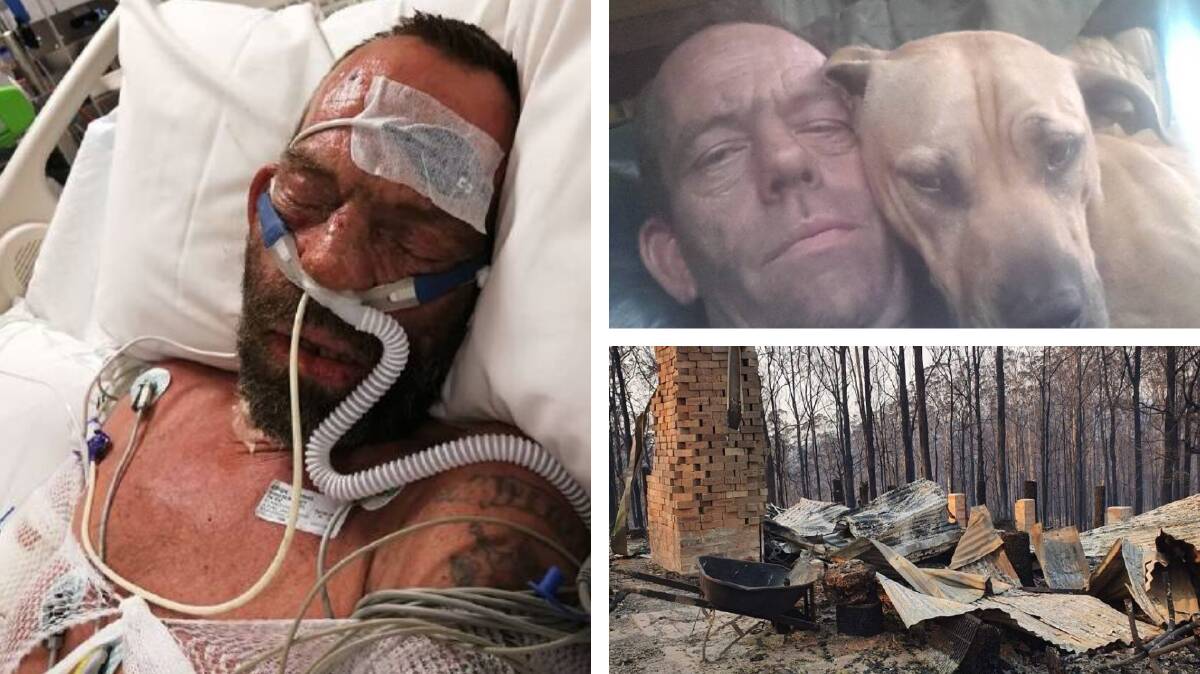 Roy Annesley: Before and after the bushfire that so very nearly cost him his life.