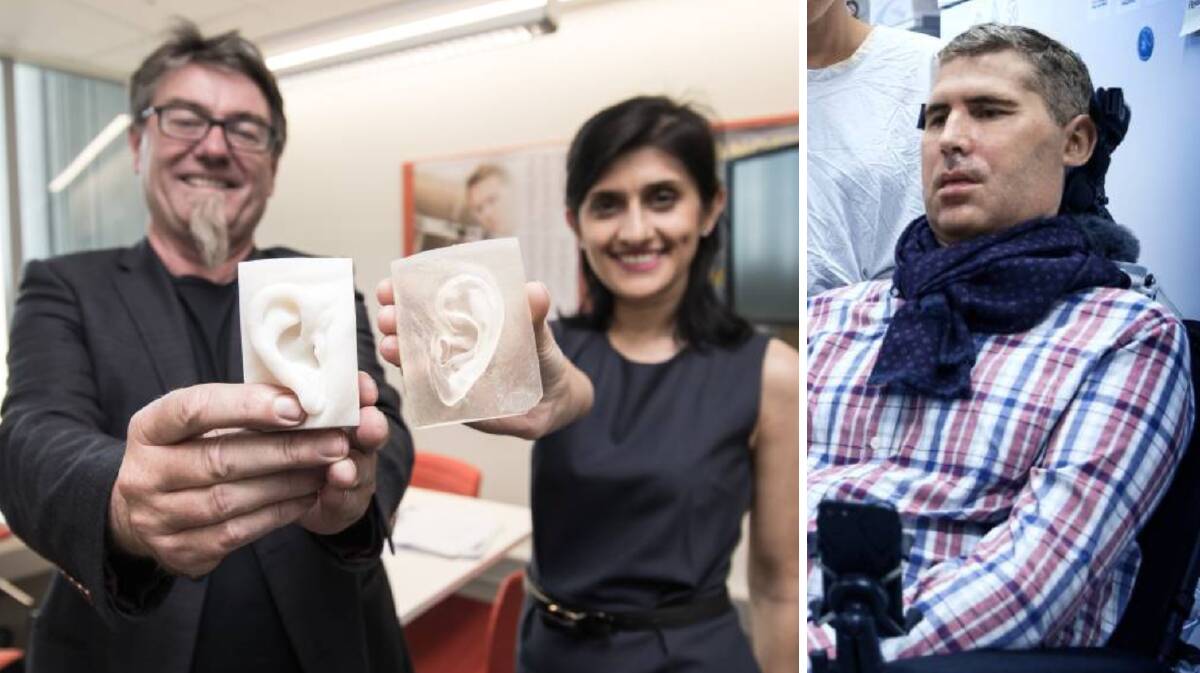 Gordon Wallace and Payal Mukherjee (left) with their 3D printed ears along with fellow prize nominess Professor Justin Yerbury (front). Pictures: supplied