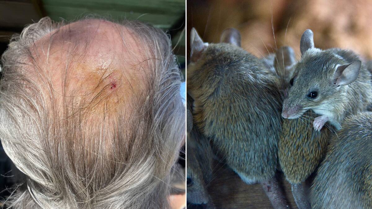 Mouse plague: Man bitten on the head as he slept