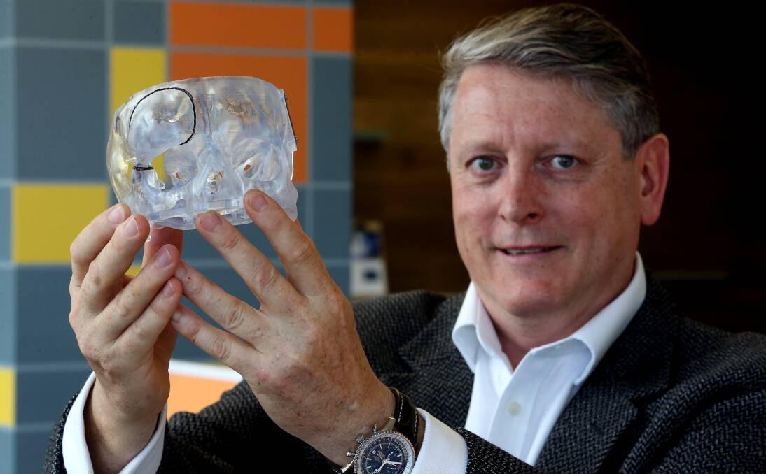 INNOVATIVE: Anatomics executive chairman Paul D'Urso holding a custom 3D printed partial skull implant at the Innovation Hub, part of Wollongong Private Hospital, on Tuesday. Picture: Robert Peet