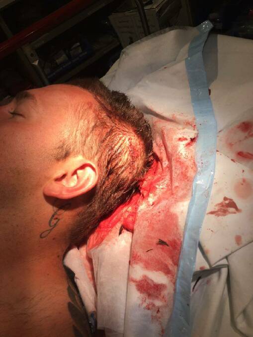 The injured man, pictured at Wollongong Hospital, required nine staples to his head. Picture: supplied