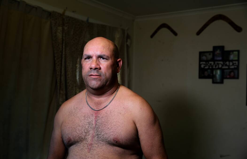 Daniel Williams from Wreck Bay shows his scars after suffering two heart attacks. Picture by Sylvia Liber