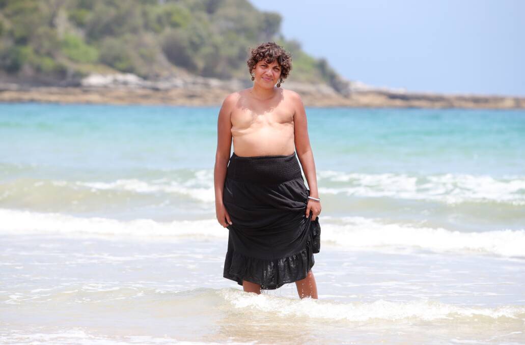 Wreck Bay woman Melinda Wellington bravely baring her scars on country in January this year. Picture by Sylvia Liber