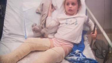 Horror playground accident: Four-year-old India Greaves broke both her legs late last month on the slide at Berry's new nature playground. Pictures: Supplied.