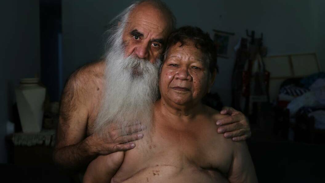 One of Sylvia Liber's winning photographs. Elder Aunty Vida Brown showing the scars from cancer, with her partner Paul. 