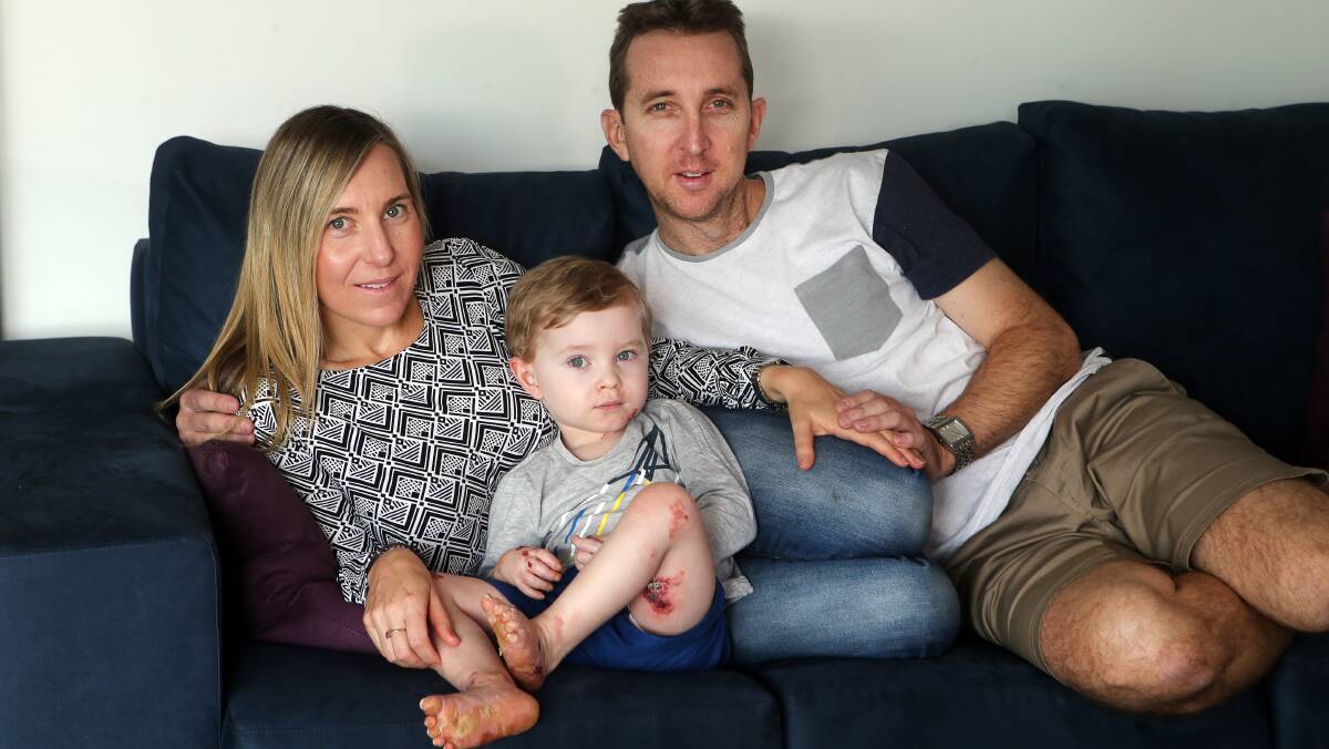 Rare condition: Melissa and Jeff North with their son Ky, 3, whose skin can blister and peel from the slightest touch. Picture: Sylvia Liber