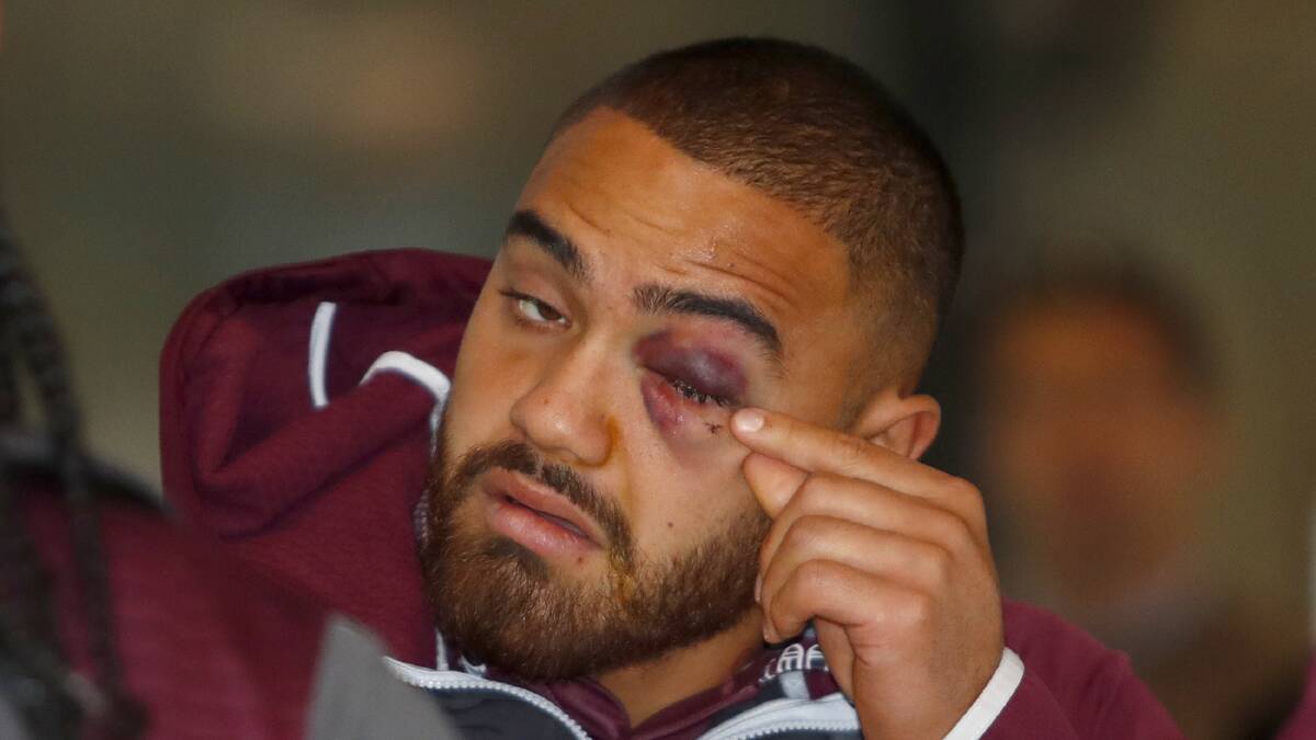 Black eye: Dylan Walker has been stood down by Manly over domestic violence allegations. Picture: AAP Image/Daniel Munoz