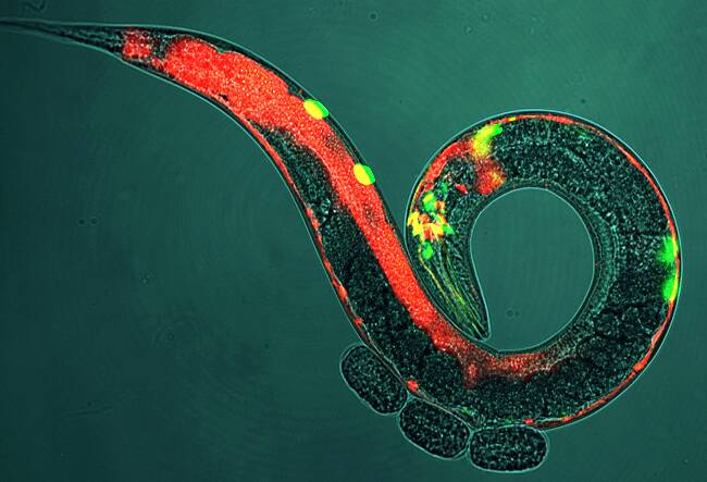 The nematode - or C.elegans - worm may help researchers better treat chronic pain in humans.