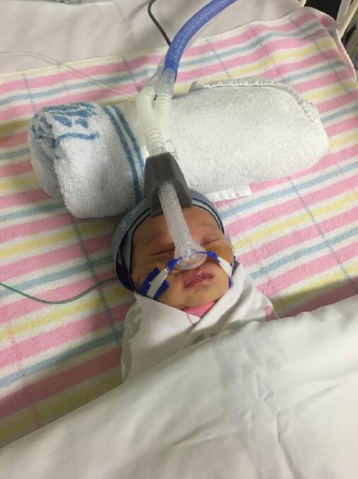 Callie spent three days on life support in Sydney Children's Hospital.