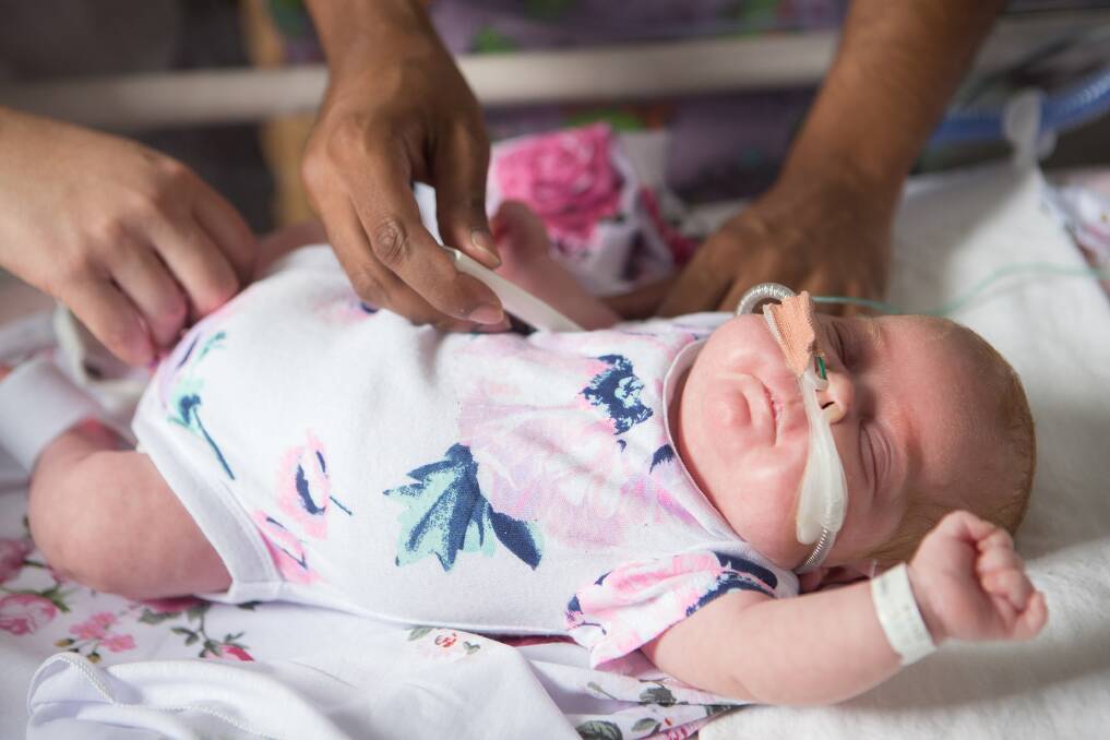 Nasal high-flow therapy is a simpler and more gentle breathing support, whereby small prongs are placed in the babys nose and gently attached to their cheeks. Picture: Royal Womens Hospital