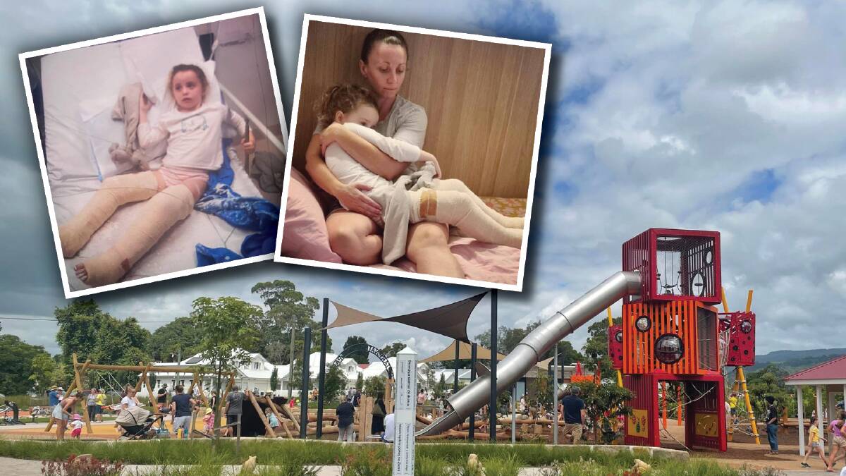 Mum's warning after four-year-old breaks both legs on Berry slide