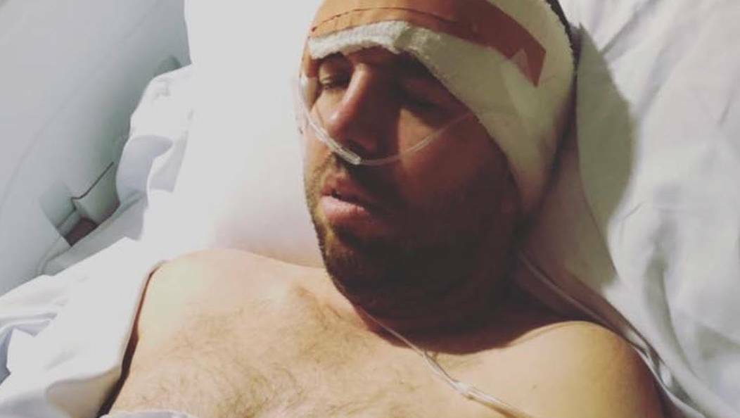 Jason Young underwent surgery to remove a brain tumour in 2018.