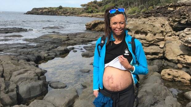 Turia Pitt's first baby with fiance Michael Hoskin is due in December.  Photo: Supplied