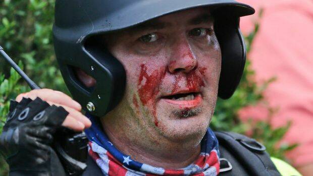 A white nationalist demonstrator left bloodied during the protest. Photo: Steve Helber