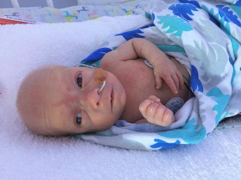Paracetamol has shown promise as a safer treatment for premature babies with PDA, such as Ollie.