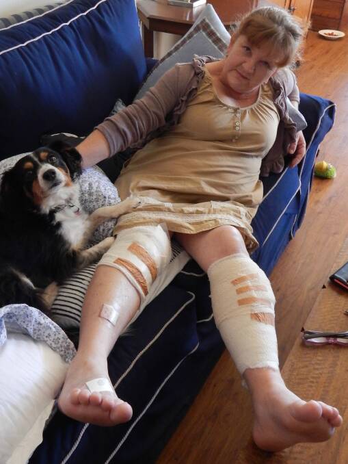 Bronwyn O'Brien recovers from a German shepherd attack at the weekend while a concerned Rosie looks on. 						        Photo: ANGELA CLUTTERBUCK