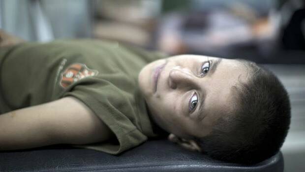A boy wounded in an Israeli strike on a compound housing a UN school in Jabalia waits for treatment. Picture: AFP