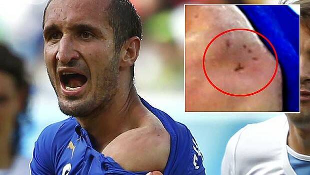Suarez bite: Giorgio Chiellini reveals teeth marks on his shoulder. Photo: Reuters
