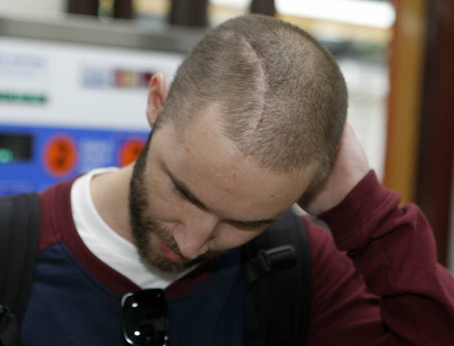 Simon Cramp carries a long zipper scar on his head, from when doctors operated to ease a fatal level of pressure in his skull following the attack.